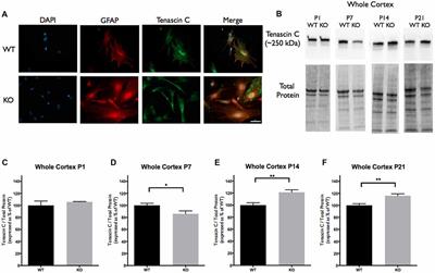 Regulation of IL-6 Secretion by Astrocytes via TLR4 in the Fragile X Mouse Model